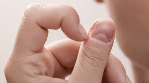 Image result for Akutní zánět nehtového lůžka