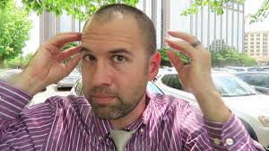 Growing Out Receding Hairline Buzz Cut: Sideburns Look Too Thick?