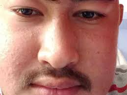 Fundraiser by Saraswoti Khatri Silwal : Support Parash Khatri's Life-Saving  Kidney Transplant