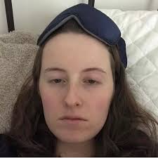 Migraines ruined my life and ended my relationship