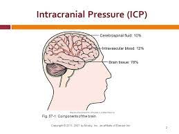 It most frequently occurs in obese women of childbearing age. Migraine Canada Intracranial Hypertension Or Pseudotumor Cerebri Basics