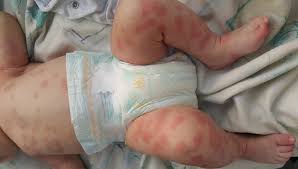 The Pan African Medical Journal Image Quiz