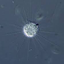 Image result for Raphidiocystis