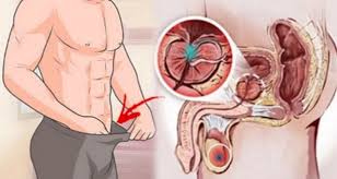 So what are the warning signs of prostate cancer? Early Warning Signs Of Prostate Cancer Your Guide To Health Wealth
