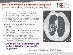 Aspergillosis — infection with the fungus aspergillus, seen especially in people with a deficient immune system. Chronic Pulmonary Aspergillosis Ppt Download