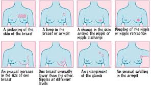 Paying heed to the early warning breast cancer signs will allow you to get the required treatment. Women Cancer Cansa The Cancer Association Of South Africa Cansa The Cancer Association Of South Africa