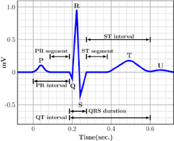 Pqrst Complexes In The Ecg Waveform Download Scientific Diagram