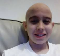 When a woman endures hair loss, it is a difficult experience wherein she may feel vulnerable and struggle with her identity. Vitor Antraco Lymphoma Canada