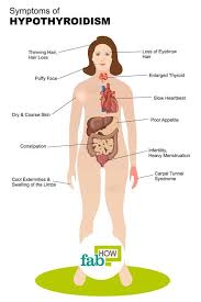 Symptoms Of Hypothyroidism Hypothyroidism Hair Loss Top 10 Home Remedies