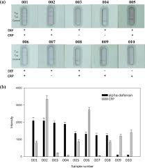 The result is a rapid test that. Development Of A Multiplex And Sensitive Lateral Flow Immunoassay For The Diagnosis Of Periprosthetic Joint Infection Scientific Reports
