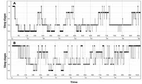 Here you will find the best sad pictures that you can use as whatsapp profile. Hypnogram Sleep Profile From A Depressed Patient Hypnogram B And A Download Scientific Diagram