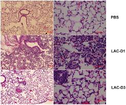 Find specific details on this topic and related topics from the merck vet manual. Transcriptional Events During The Recovery From Mrsa Lung Infection A Mouse Pneumonia Model