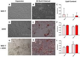 Petan lay south of t'u lung and west of the warring states. Gels Free Full Text Bioprinted Three Dimensional Cell Laden Hydrogels To Evaluate Adipocyte Breast Cancer Cell Interactions Html