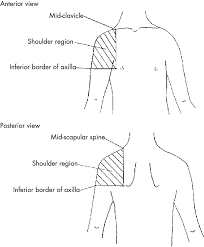 Shoulder pain can develop from problems in any part of the shoulder. Predefined Shoulder Region Pain Download Scientific Diagram