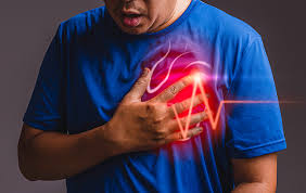 O enfarte agudo do miocárdio, vulgarmente conhecido como ataque cardíaco, ocorre quando uma das artérias do coração fica obstruída por um coágulo, o que faz com que uma parte do músculo cardíaco deixe de funcionar por falta de oxigénio e nutrientes. Infarto Agudo Do Miocardio Sintomas E Tratamentos Cepic