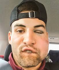 After a fastball to the face, Dan Motl, Gophers revel in first place