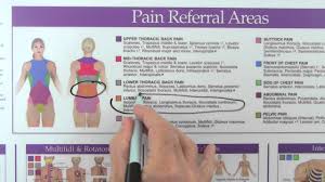 Spine Thorax And Abdomen Trigger Point Wall Chart Youtube