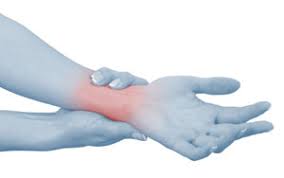 Intersection syndrome is a chronic, overuse injury in the distal radial forearm where the tendons of the 1st extensor compartment and the 2nd extensor compartment cross over, resulting in bursitis or. Advice Intersection Syndrome And Treatment