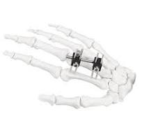 Mini Fragment External Fixator (Finger and Palm)