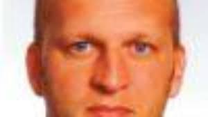 Miniscrews in the Anterior Palate