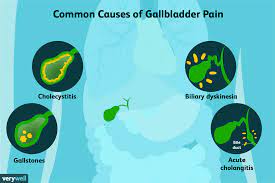 During the digestion process, your gallbladder releases bile through a duct into the small intestines. Gallbladder Pain Causes Treatment And When To See A Doctor