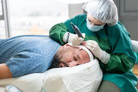 Hair Transplant Procedures: Average Cost, What to Expect, and More