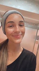 Natural facial with extractions recommendations needed