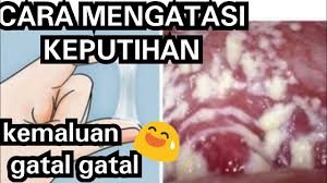 Kompres dingin untuk menghilangkan gatal secara instan bisa gunakan kompres dingin. Mengatasi Pelepasan Faraj Kekuningan