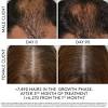 Celebrity Thinning Hair
