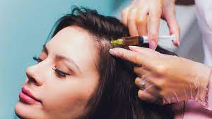Reasons you may want fue in toronto. Prp Hair Loss Restoration Toronto Dermatology Centre