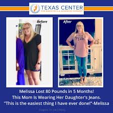 Pin On Weight Loss Surgery Transformations