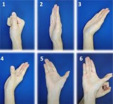 Karpal Tunel Sendromu El Bileginde Sinir Sikismasi Nedir Saglikta Yenilikler