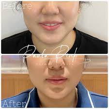 Paula PINKriangkrai (@nursepaulapink) • Instagram photos and videos