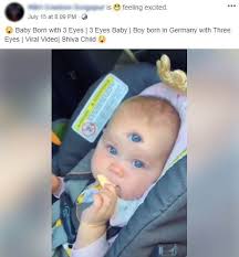 An Edited Video Falsely Shared As A Video Of Baby Born With Three Eyes Factly