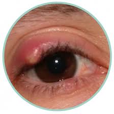 Image result for Blepharis gazensis