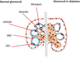 Maybe you would like to learn more about one of these? Diabetic Nephropathy Is There A Role For Oxidative Stress Sciencedirect