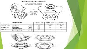 Image result for Pelvimetry