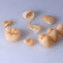 Resin inlay dental from www.nelsonridge.com