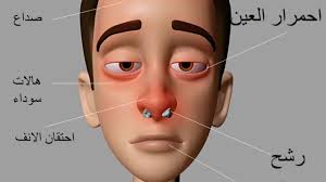 إذا رأت البنت في الحلم أن هناك دم ينزل من انفها فذلك دليل على وجود مشاكل نفسية أو عاطفية تعاني منها. ØªÙØ³ÙŠØ± Ø­Ù„Ù… Ø§Ù„Ø§Ù†Ù Ø§Ù„Ù…Ù‚Ø·ÙˆØ¹ ÙÙŠ Ø§Ù„Ù…Ù†Ø§Ù… Ù…ÙˆÙ‚Ø¹ Ø§Ù„Ø±Ù‡ÙŠØ¨