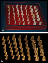 Root Surface Area Measurement Of Permanent Dentition In