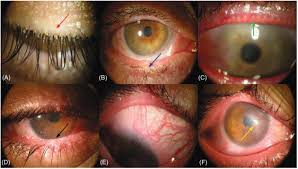 Image result for Blepharis bainesii