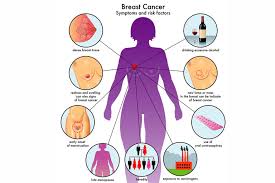As the cancer progresses, signs and symptoms can include a. Breast Cancer Symptoms Causes And Prevention Doctor Asky