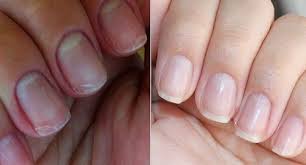Naara Em Capsulas Hair And Nails Colageno Hidrolisado Mercado Livre Imecap hair e um suplemento de vitaminas e minerais comercializados pela divcom pharma / vidfarma no brasil. naara em capsulas hair and nails colageno hidrolisado