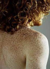 Freckles Redheads Freckles Red Hair Red Hair Quotes