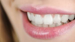 In fact, tooth enamel is the hardest substance in the body — even harder. Teeth Are Becoming See Through Cosmetic Dentistry By Dentists In Leicester Smile Essential