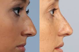 Image result for nose
