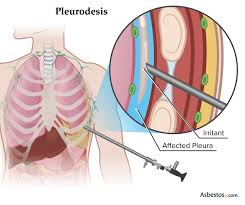 Image result for Pleiotaxis