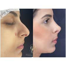 Instituto Priscilla Barros (@dra.priscillabarross) • Instagram photos and  videos