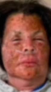 This you, Arlene Bunch? I'm sorry you exploded, but being racist to  children is 100% unacceptable. Credit /rx0rcist