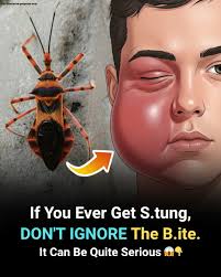 DON'T IGNORE this—it can be quite serious. Here's what they are and what  you should do 👇👇👇